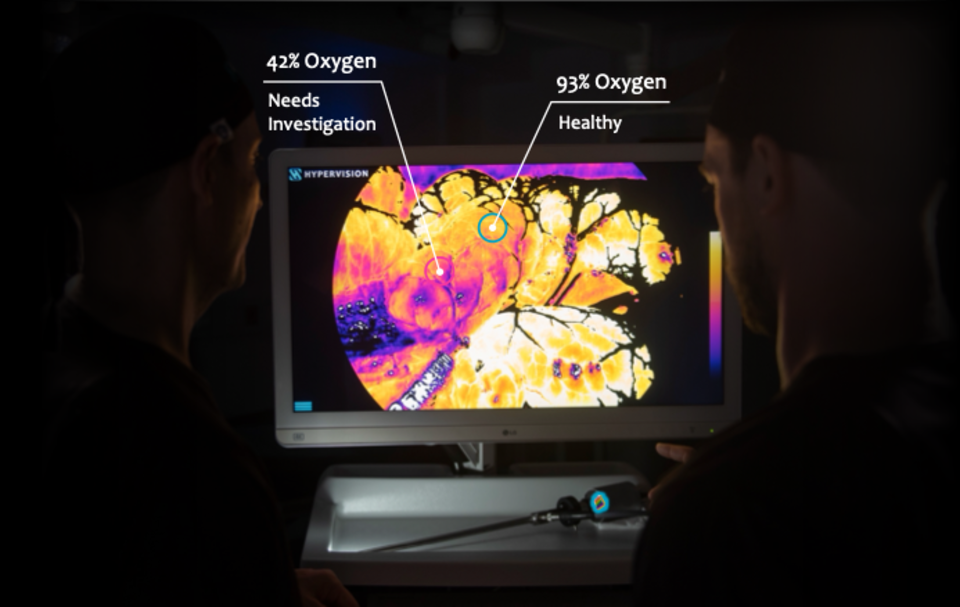 Hypervision Surgical Raises £17 Million Series A to Power Surgical Intelligence Through Hyperspectral Vision
